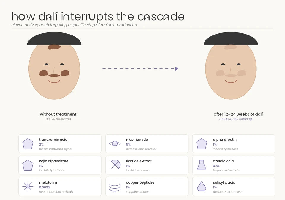 Dalí infographic pairing a before-and-after illustration with ingredient roles in the pigment pathway, including tranexamic acid, niacinamide and alpha arbutin.